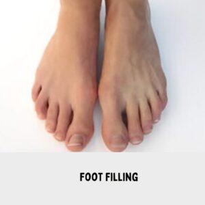 Foot Filling