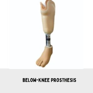 Below-Knee Prosthesis