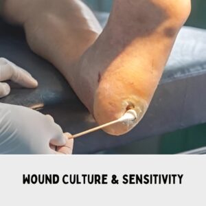 Wound Culture & Sensitivity 