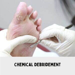 Chemical Debridement