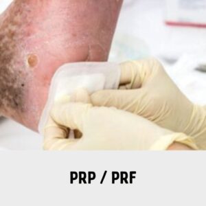 PRP / PRF