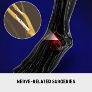 Nerve-Related Surgeries