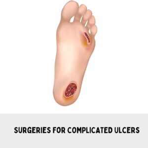 Surgeries For Complicated Ulcers